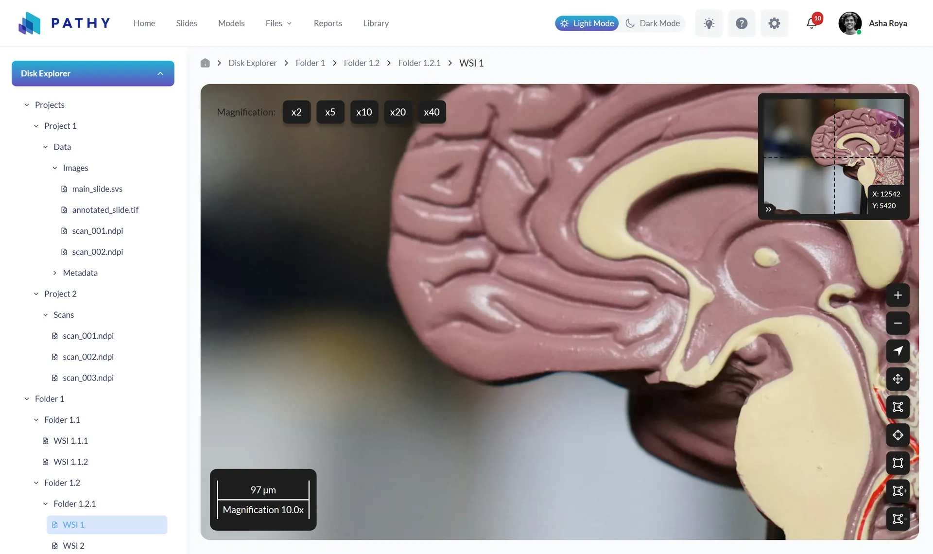Whole-slide-image viewer with magnification presets, annotation toolbar, minimap, and a dynamic scale bar