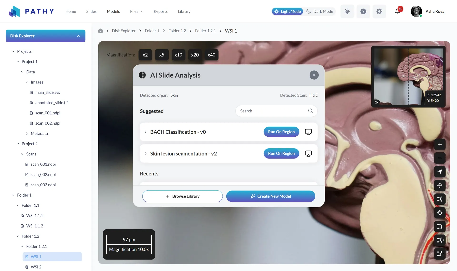 AI slide analysis panel over an open slide showing detected organ, stain, and suggested models